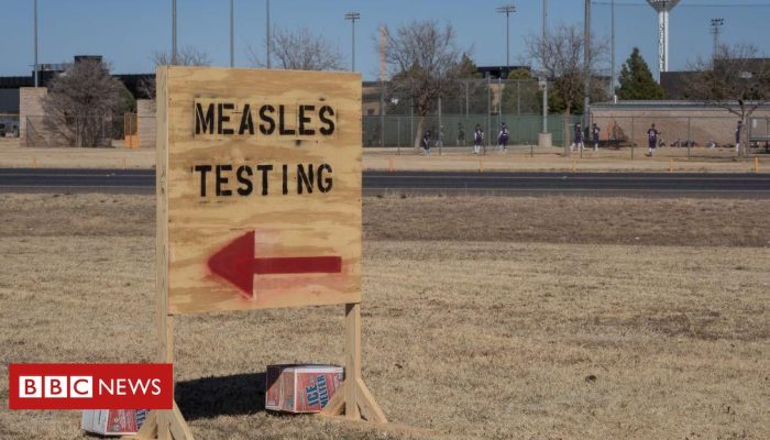 1338b8d0-12f4-11f0-8bc5-d317b6dd5c85.jpg 1338b8d0-12f4-11f0-8bc5-d317b6dd5c85.jpg