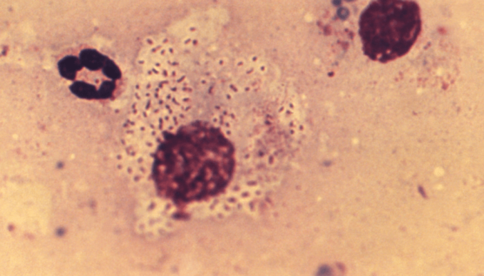 2048px-Donovan_bodies_Klebsiella_granulomatis_PHIL18899.png