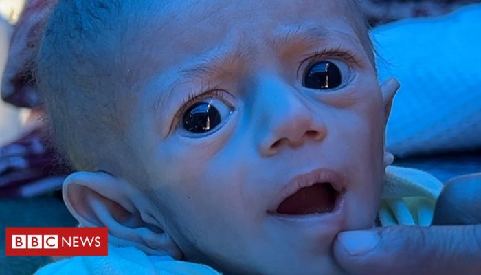 436d9440-39a4-11f0-96c3-cf669419a2b0.jpg 436d9440-39a4-11f0-96c3-cf669419a2b0.jpg