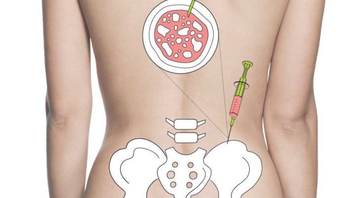 495-medicina-doacao-medula.jpg 495-medicina-doacao-medula.jpg