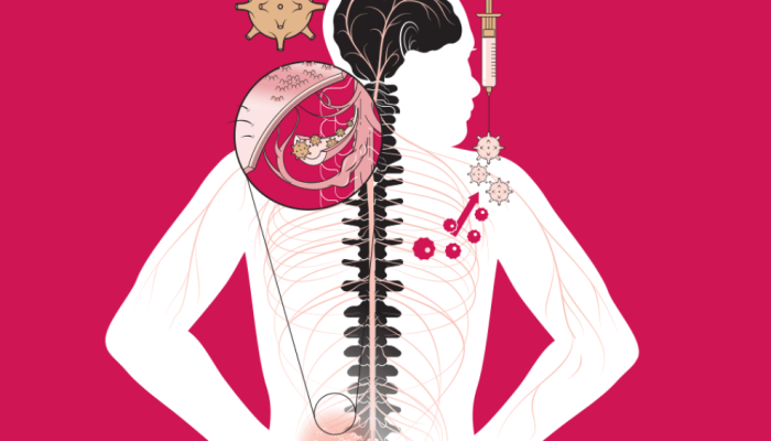 497-sqs-vacina-herpes-zoster.png 497-sqs-vacina-herpes-zoster.png