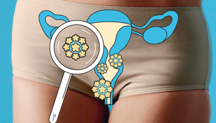 510-medicina-hpv.png 510-medicina-hpv.png