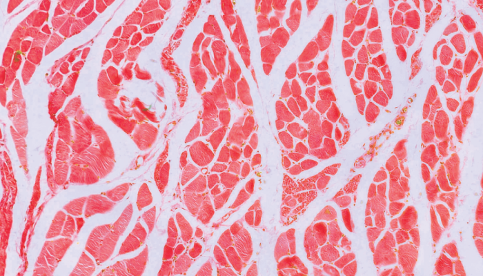 513-zoom-coracao.png 513-zoom-coracao.png