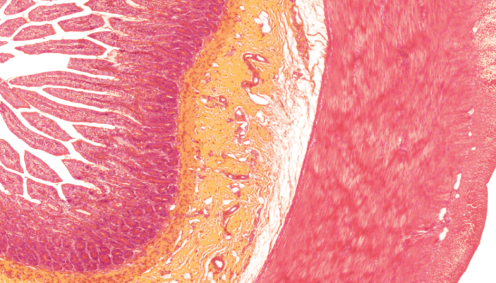 514-zoom-1.png 514-zoom-1.png