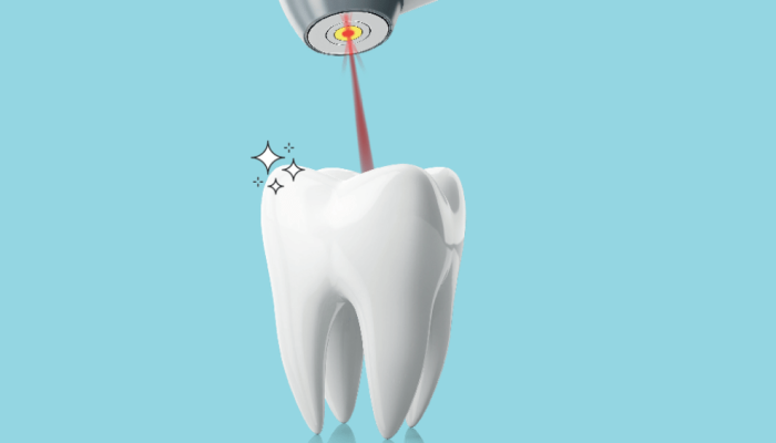 516-autoestima-laser-dente.png