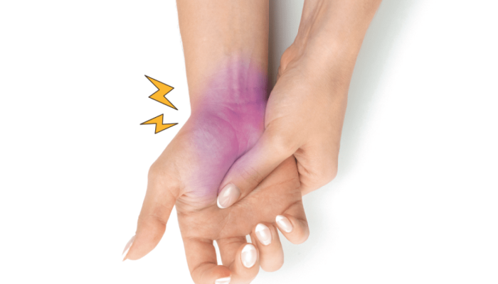 518-medicina-tunel-do-carpo-dor-punho.png 518-medicina-tunel-do-carpo-dor-punho.png