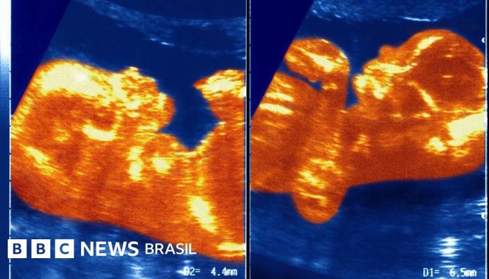 9e3791b0-7d46-11f0-8fd8-cf1c7206193d.jpg 9e3791b0-7d46-11f0-8fd8-cf1c7206193d.jpg