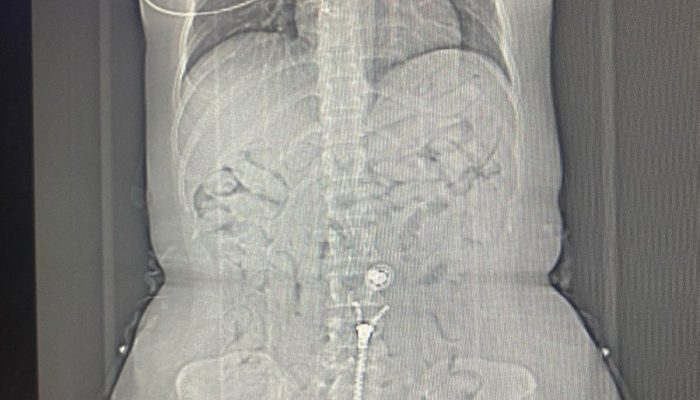 WhatsApp-Image-2025-02-15-at-16.04.59.jpeg WhatsApp-Image-2025-02-15-at-16.04.59.jpeg