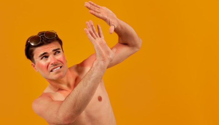 acne-solar-queimadura-sol.jpg acne-solar-queimadura-sol.jpg