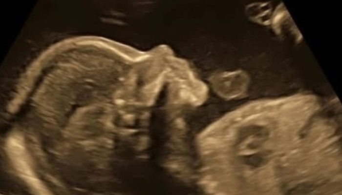 bebe-5-meses-de-gestacao.jpeg bebe-5-meses-de-gestacao.jpeg