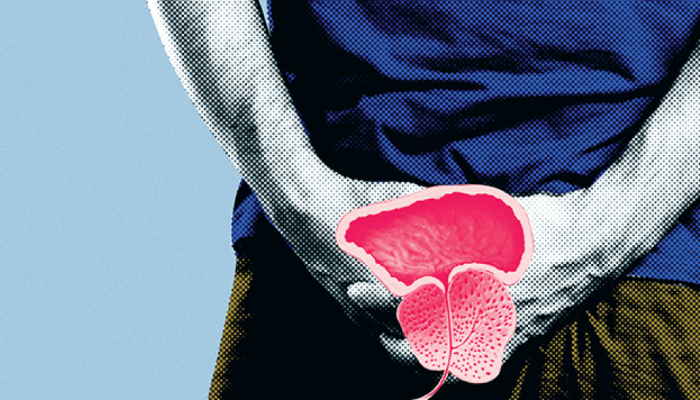 biopsia-de-prostata.png biopsia-de-prostata.png