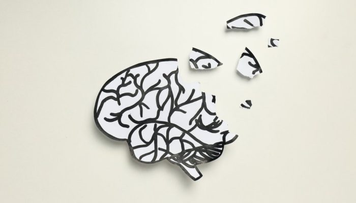 demencia-alzheimer-parkinson-doenca-neurodegenerativa.jpg demencia-alzheimer-parkinson-doenca-neurodegenerativa.jpg