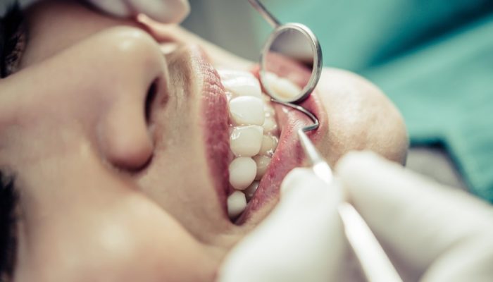 dentista-restauracao-dente.jpg dentista-restauracao-dente.jpg