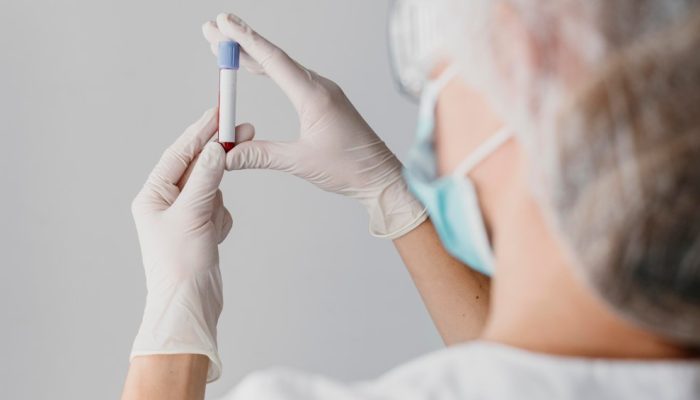 exame-de-sangue-ferro-serico.jpg exame-de-sangue-ferro-serico.jpg