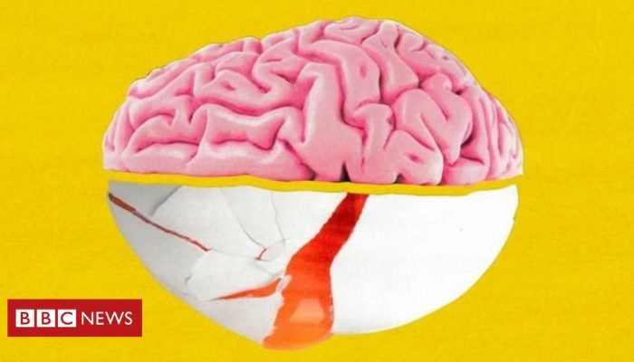 f795a650-1a24-11f0-b1b3-7358f8d35a35.jpg f795a650-1a24-11f0-b1b3-7358f8d35a35.jpg