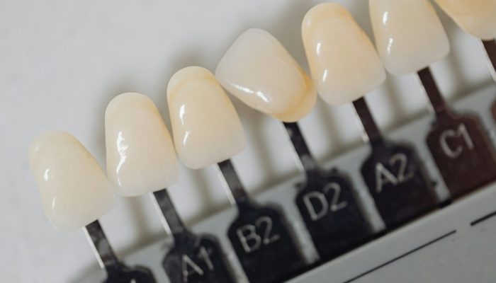 faceta-dentes-materiais-2.jpg faceta-dentes-materiais-2.jpg