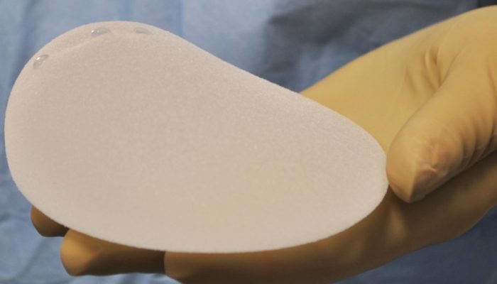 implante-silicone.jpg
