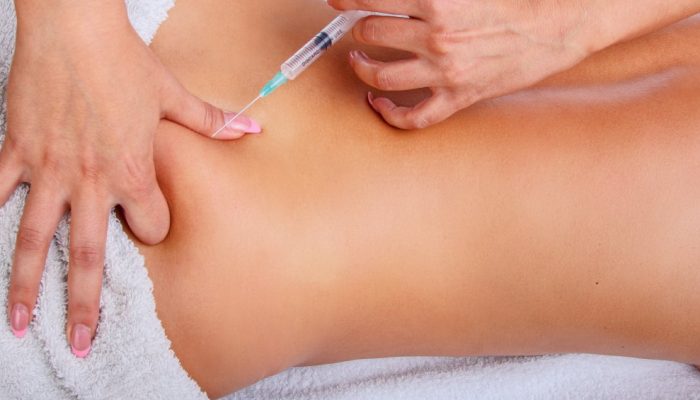injecao-de-seringa-nas-costas-da-mulher-mulher-desfrutando-de-massagem-relaxante-nas-costas-no-centr.jpeg injecao-de-seringa-nas-costas-da-mulher-mulher-desfrutando-de-massagem-relaxante-nas-costas-no-centr.jpeg