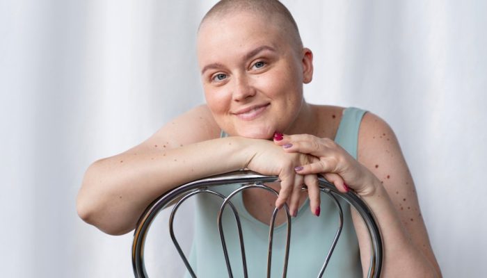 jovem-lutando-contra-o-cancer.jpg jovem-lutando-contra-o-cancer.jpg