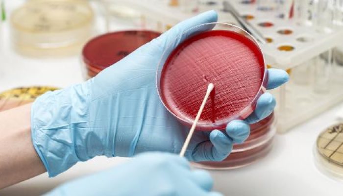 laboratorio-placa-de-petri-1579183958534_v2_615x300.jpg