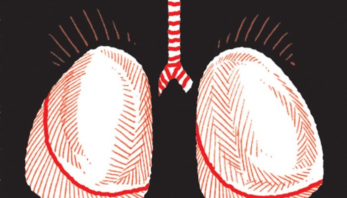 pulmc3a3o04.jpg pulmc3a3o04.jpg