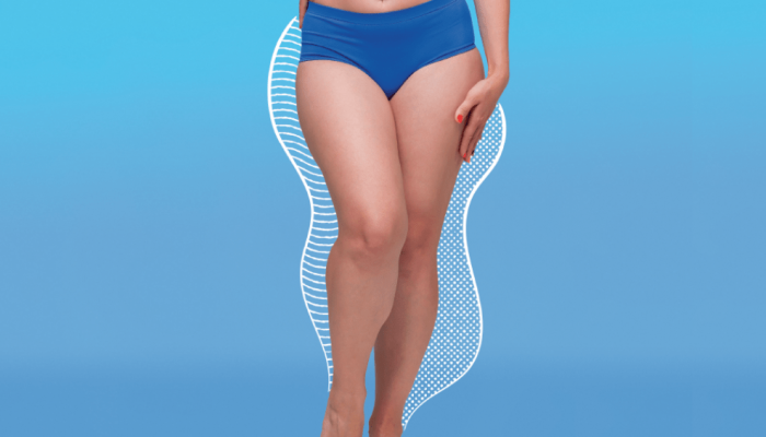 saude-medicina-lipedema.png saude-medicina-lipedema.png