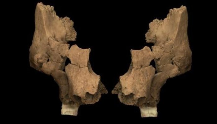 vista-frontal-da-reconstrucao-virtual-da-face-do-humano-pink-1741869417196_v2_615x300.jpg vista-frontal-da-reconstrucao-virtual-da-face-do-humano-pink-1741869417196_v2_615x300.jpg