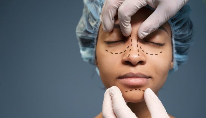 woman-getting-ready-nose-job-surgery.jpg